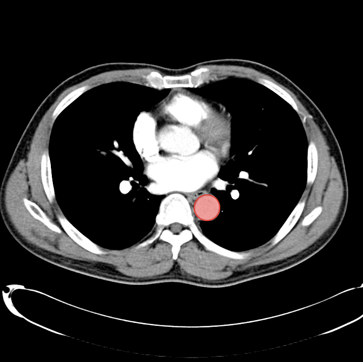 Differential Diagnosis Of Infographic Ct Abdomen Pelvis Interpretation